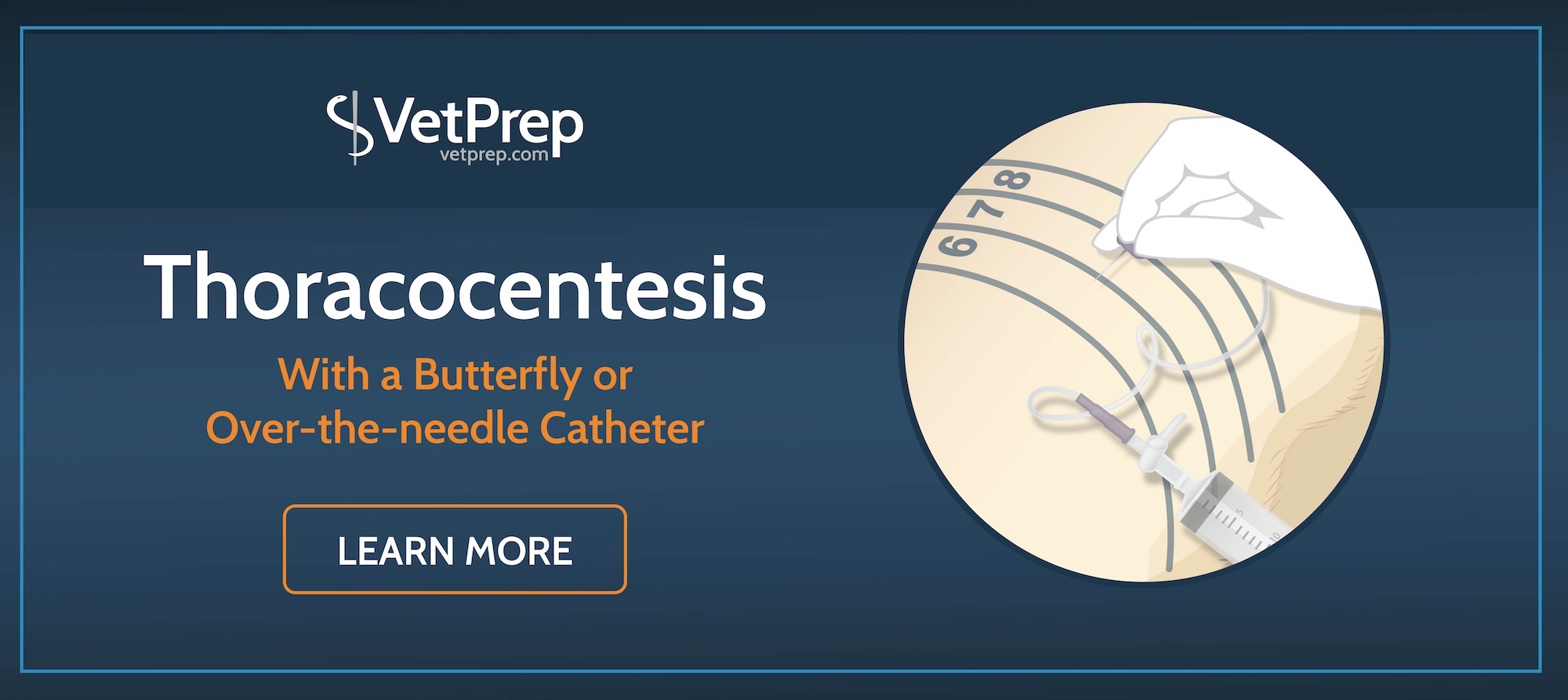 How to Use a Butterfly Catheter